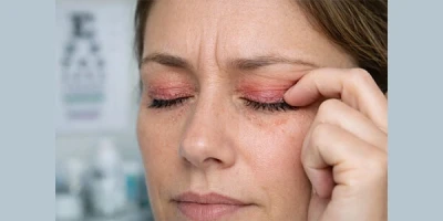 دلایل و درمان خشکی و خارش پلک